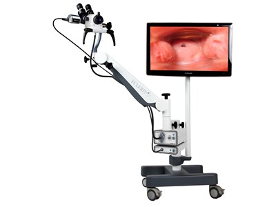 Binocular viewing colposcope